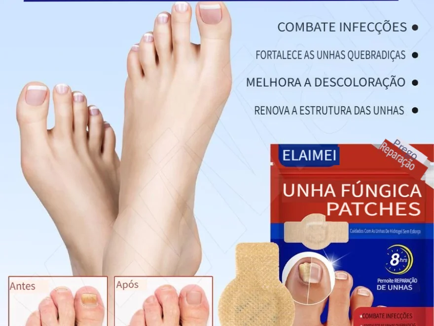 5BEntrega202420horas5DEELHOE Adesivo20de20tratamento20de20unhas2C20antibacteriano20de20longa20duraC3A7C3A3o2C20repara20infecC3A7C3A3o20fC3BAngica 880x660